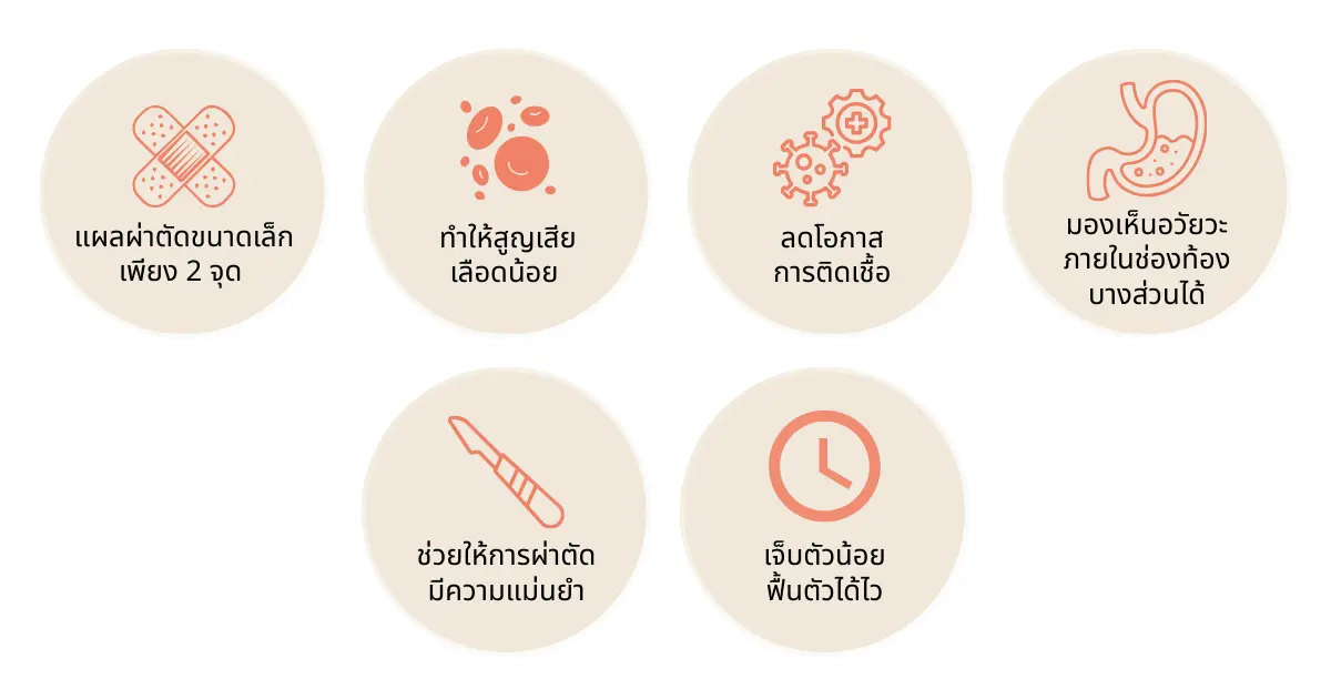 อินโฟกราฟิกแสดงข้อดี 6 ประการของการทำหมันส่องกล้อง เช่น แผลเล็กเพียง 2 จุด และฟื้นตัวไว